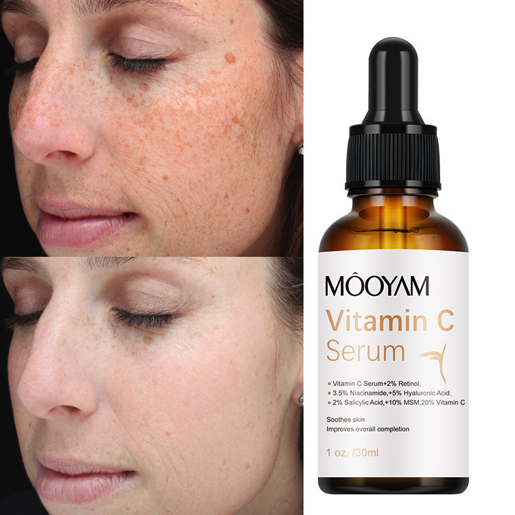Review Cuidados com a pele vitamina C essência hidratante vitamina C soro, vitamina C hidratante essência antirrugas: Vale a Pena em 2026?